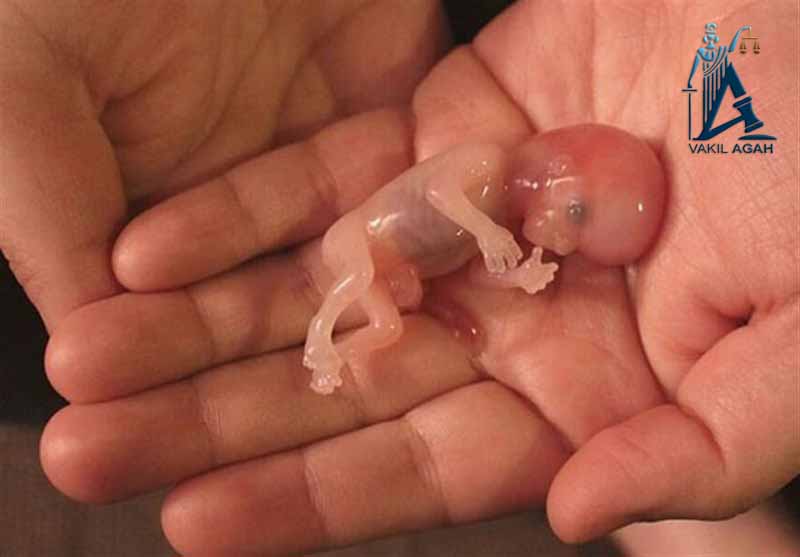 سقط جنین چیست؟ + علائم، علت و مشکلات آن