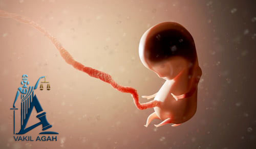 سقط جنین در مشهد